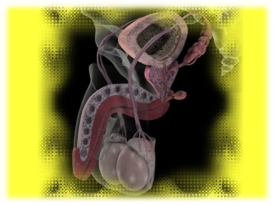 3D компьютерная томография при венозной эректильной дисфункции